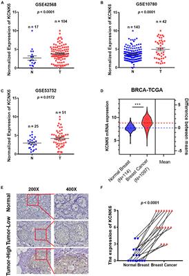 Potassium Channel Protein KCNK6 Promotes Breast Cancer Cell Proliferation, Invasion, and Migration